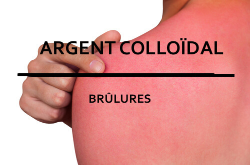 Argent_colloidal_brulures